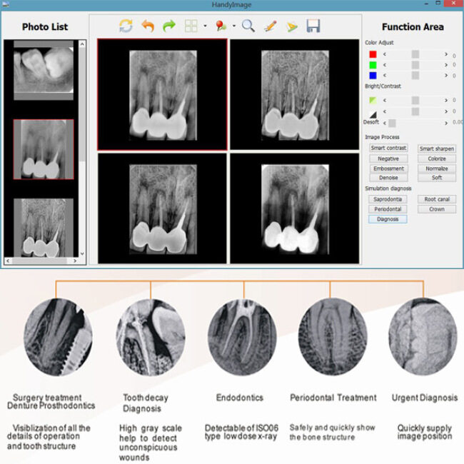 China Dental X-ray Sensor USB Handy Digital System